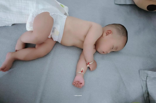 晋江宝宝头上长痱子